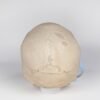 Medical Skull with Signs of Trauma (0381) - Image 4