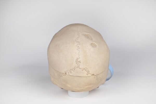 Medical Skull with Signs of Trauma (0381) - Image 4