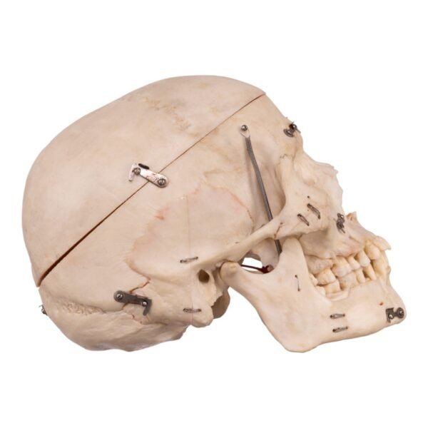 Real Human Dissected Skull with Carrying Case

(36132) - Image 2