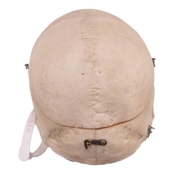 Real Human Dissected Skull with Carrying Case

(36132) - Image 4