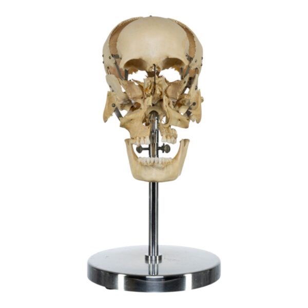 Exploded Skull on Stand
(33618)