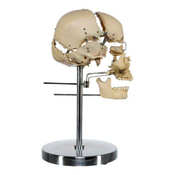 Exploded Skull on Stand
(33618) - Image 3