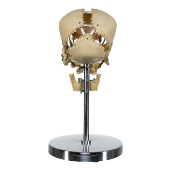Exploded Skull on Stand
(33618) - Image 4