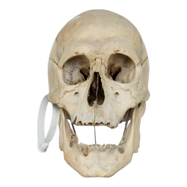 Human Skull