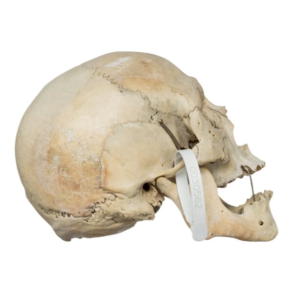 Human Skull - Image 4