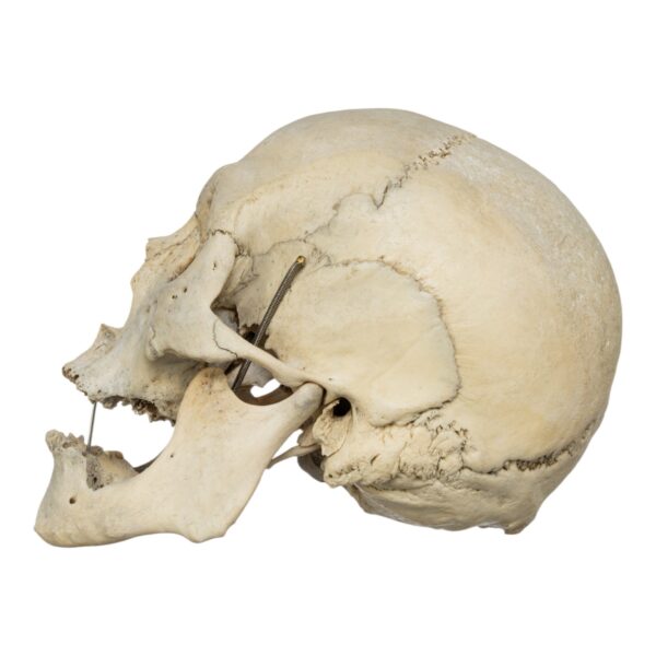 Human Skull - Image 2