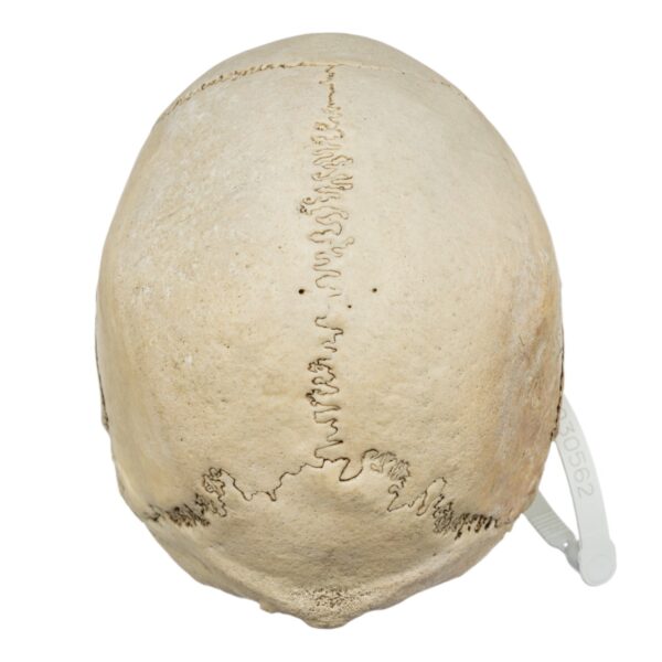 Human Skull - Image 3