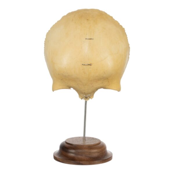 Frontal Bone on Stand

(5398) - Image 3