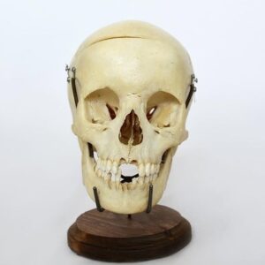 human skull
(4432)