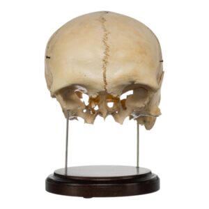 Human Partial Skull on Stand