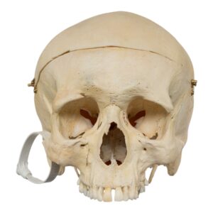 Human Skull - No Mandible