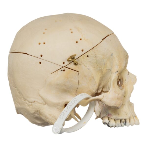 Human Skull - No Mandible - Image 4