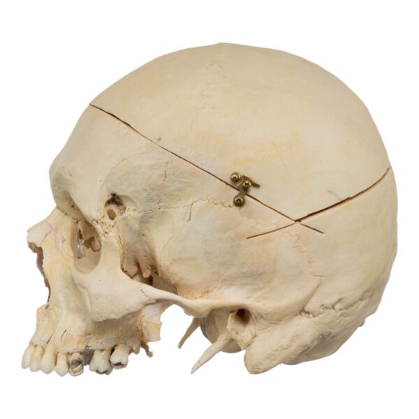 Human Skull - No Mandible - Image 3
