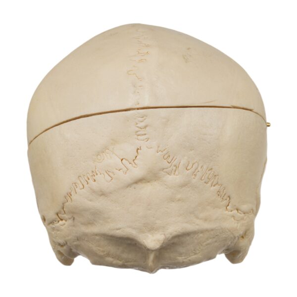 Human Skull - No Mandible - Image 5