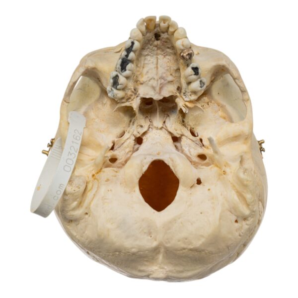 Human Skull - No Mandible - Image 2
