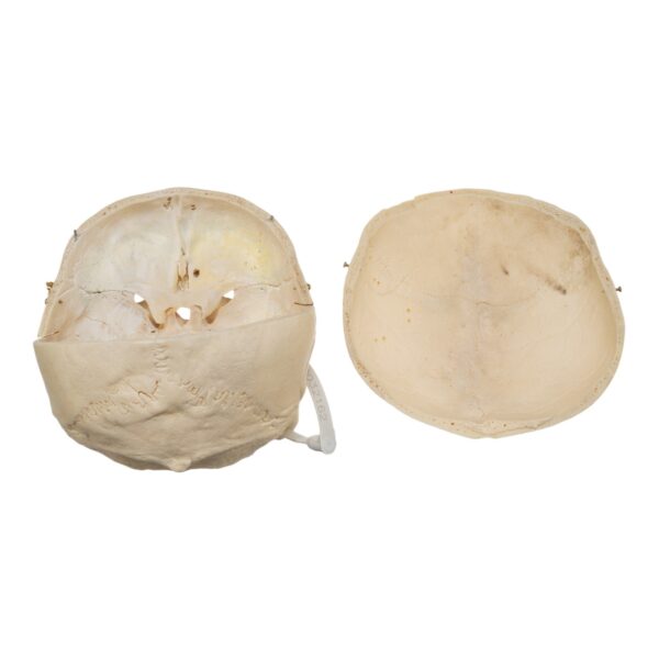 Human Skull - No Mandible - Image 6